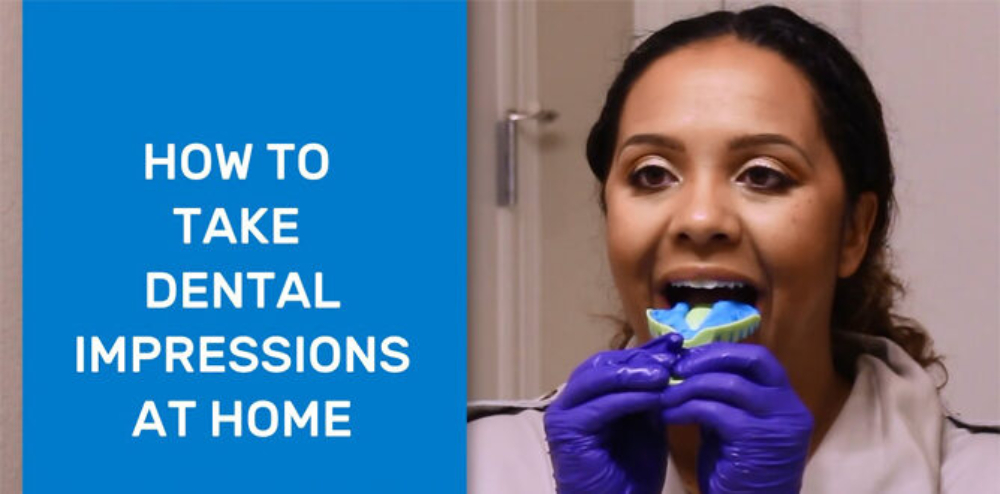 What Are Dental Impressions And What Are They Used For?